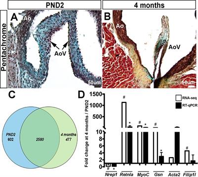 Postnatal and Adult Aortic Heart Valves Have Distinctive Transcriptional Profiles Associated With Valve Tissue Growth and Maintenance Respectively